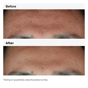 More Molecules Feuchtigkeitsserum Niacinamide 10% + Zinc 1%