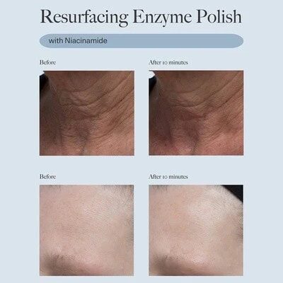 Resurfacing Enzyme Polish