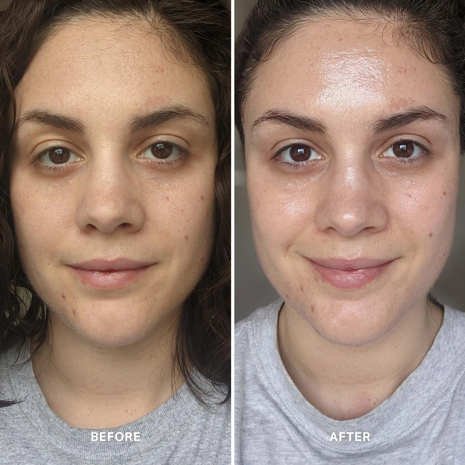 Alpha-H Liquid Gold Exfoliating Treatment with 5% Glycolic Acid 100ml
